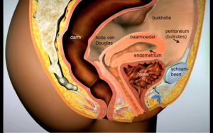 766-endometriose-is-de-buik-1