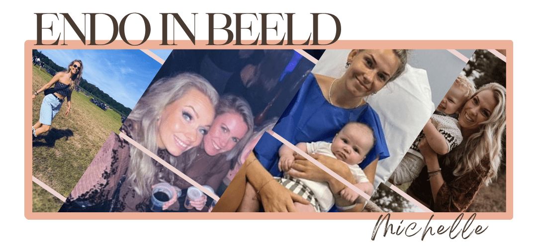 endo-in-beeld-header endo-in-beeld-header