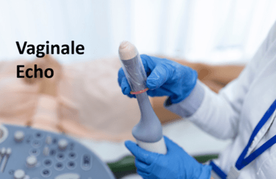 vaginale-echographie